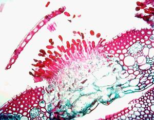 uredinium