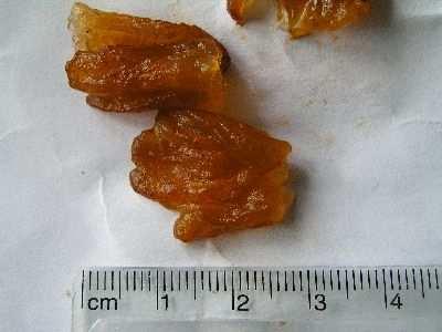 Ř: Pucciniales Gymnosporangium sabinae teliární stádium na jalovci obligátní parazité