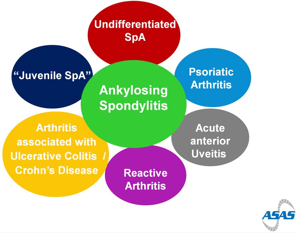 Spondyloartritidy