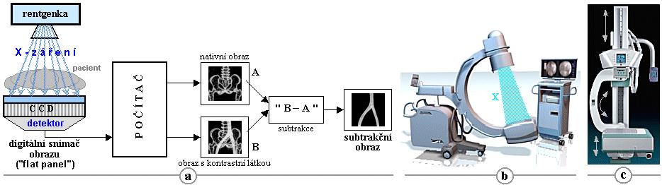Digitální subtrakční angiografie (DSA) vyšetření se provádí na zvláštním pracovišti angiografický sál (angiolinka, angiosuit) veškeré instrumentárium (katétry, vodiče) se zavádí pod skiaskopickou