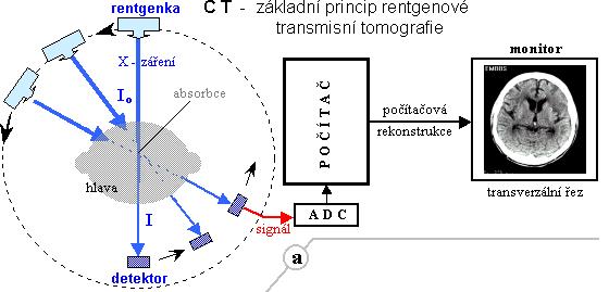 Schéma CT vyšetření Více informací zde: