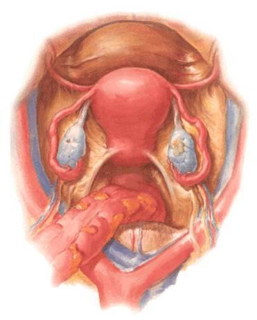 Vnitřní ženské pohlavní ústrojí Organa genitalia feminina interna ovarium = vaječník tuba uterina