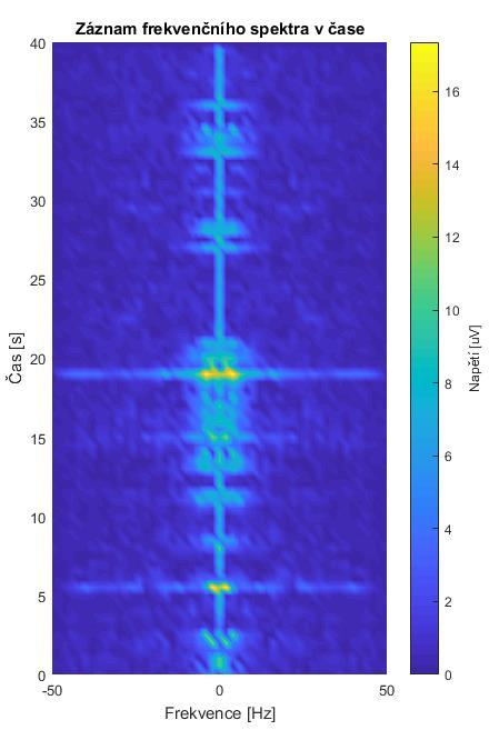 Obrázek 26 EEG data monitoring, graf-frekvenční spektrum Záznam frekvenčního spektra v čase Třetí graf přehledně