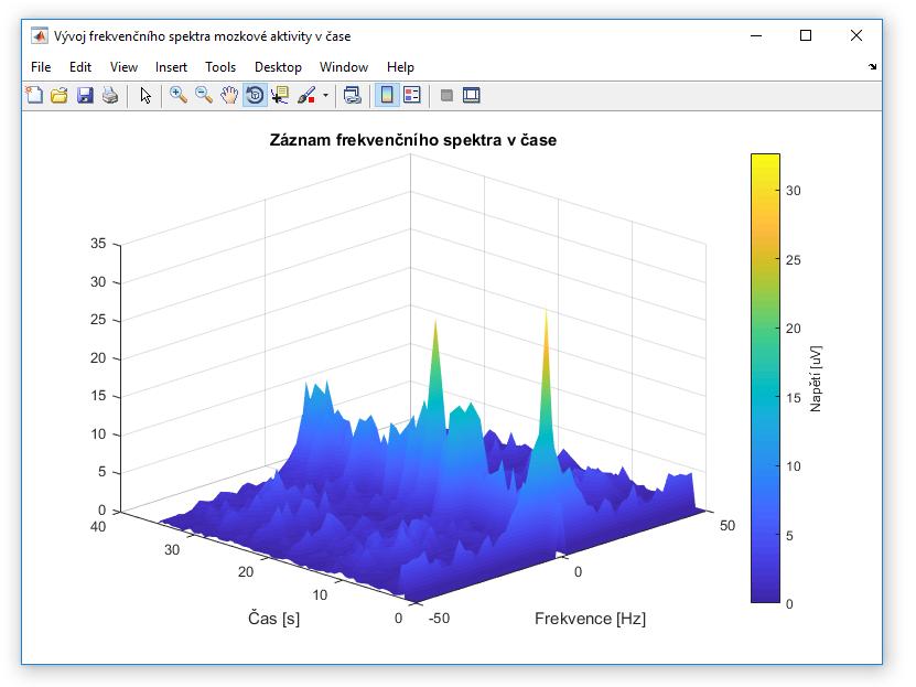 Obrázek 40 QuickMath, závěrečné okno Klinutím na tlačítko Zobrazit EEG data se vytvoří nové okno a v něm se vykreslí záznam frekvenčního spektra mozkové aktivity v čase (Obr. 41).