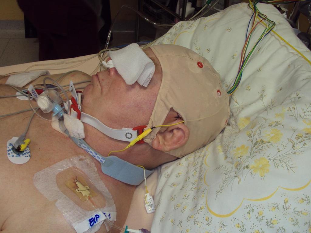 EEG