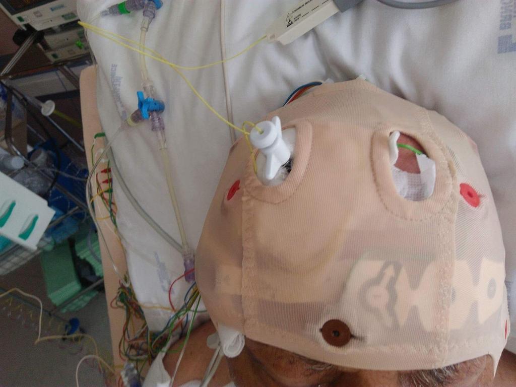 EEG čepice s