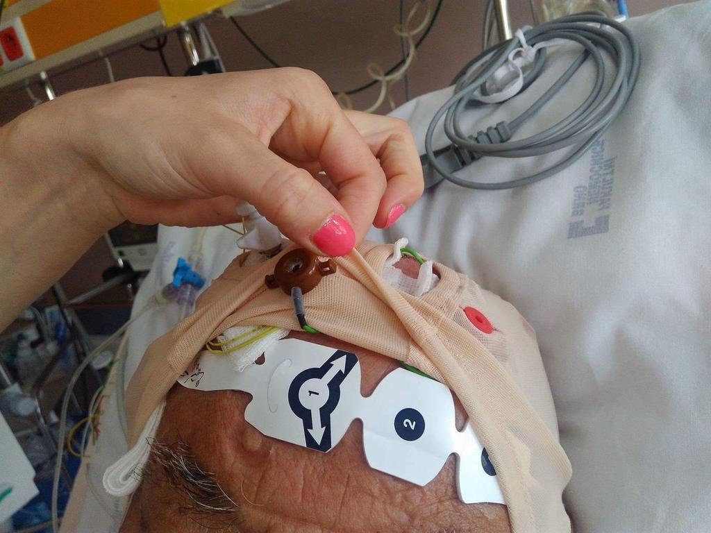 EEG a BIS