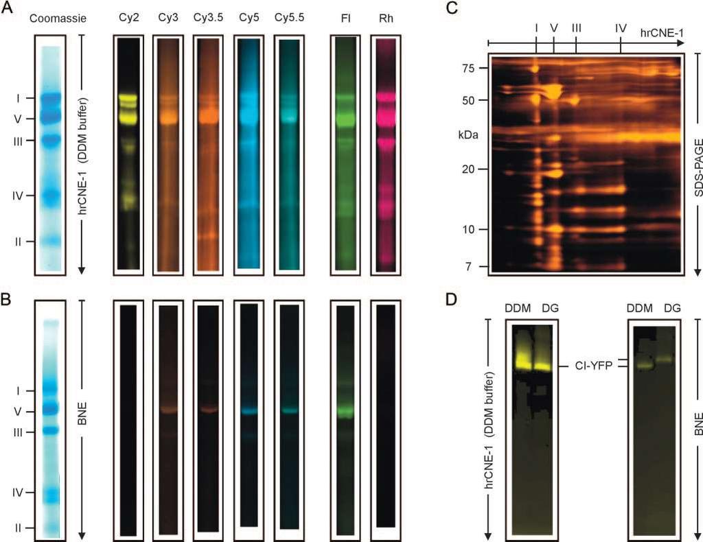 High-resolution CLEAR NATIVE ELECTROPHORESIS CBB je nahrazena anionickýcm detergentem (např.