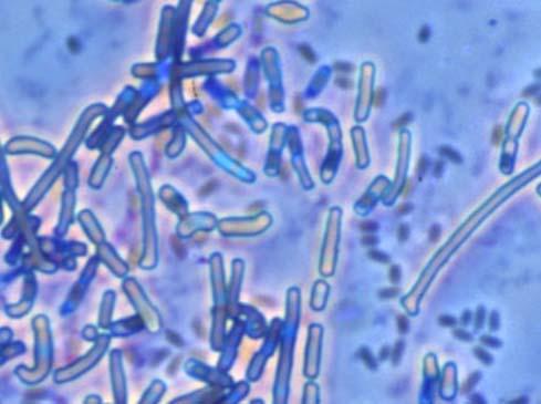 ČOV. V rámci výzkumných projektů RECETOX byla optimalizována serie kontaktních testů pro hodnocení ekotoxicity půdy a příbuzných matric.