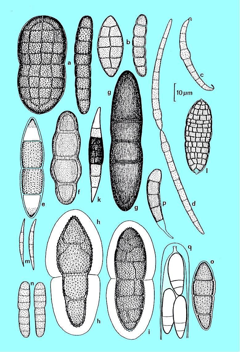 Příklady rozmanitosti askospor u