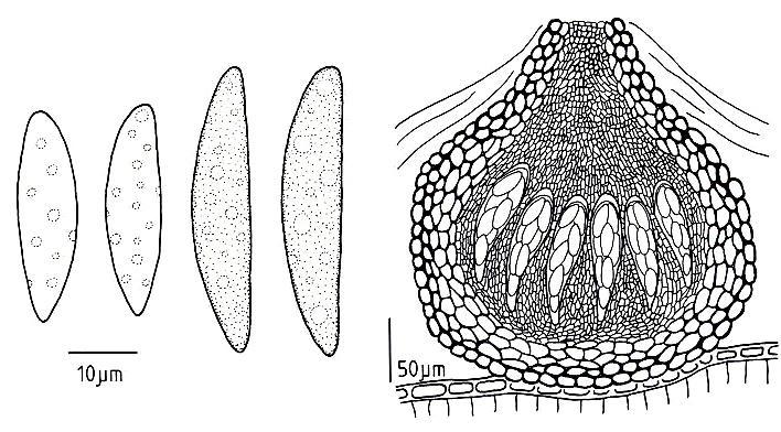 Botryosphaeria