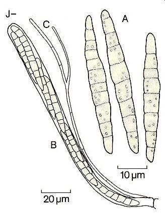 Urtica dioica