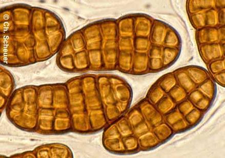 MYKOLOGIE 10. lekce Říše Fungi: ASCOMYCOTA (part 5) Pezizomycotina III.