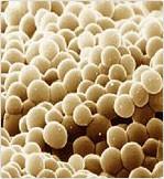 ) Zdrojem dusíku jsou amonné ionty a aminokyseliny Laboratorní podmínky: YPD bohaté médium = 10g/l yeast extract, 20g/l
