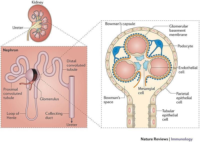 NEMOCI GLOMERULŮ (GLOMERULOPATIE) Heterogenní skupina chorob postihující glomeruly Glomerulonefritidy zánětlivé