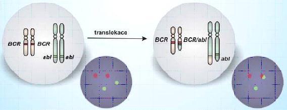 FISH 2: Detekce translokace chromozomů Pro detekci se použijí dvě sondy značené odlišnými fluorescenčními barvami. Každá sonda se váže k sekvenci jednoho z genů.