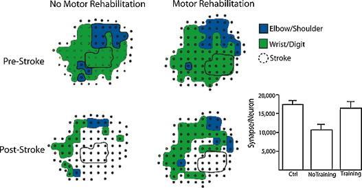 Obr. 1: Ilustrace vlivu pohybové terapie na plasticitu mozku Zdroj: KLEIM, Neural plasticity and neurorehabilitation. Teaching new brain old tricks, online, cit. 2013-02-20 1.