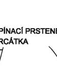 vzdálenosti od sebe aby respektovaly lokální diskontinuityy zdiva.