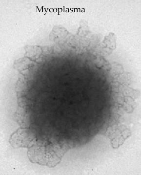 rody Mycobacterium, Corynebacterium, Haemophillus, Mycoplasma