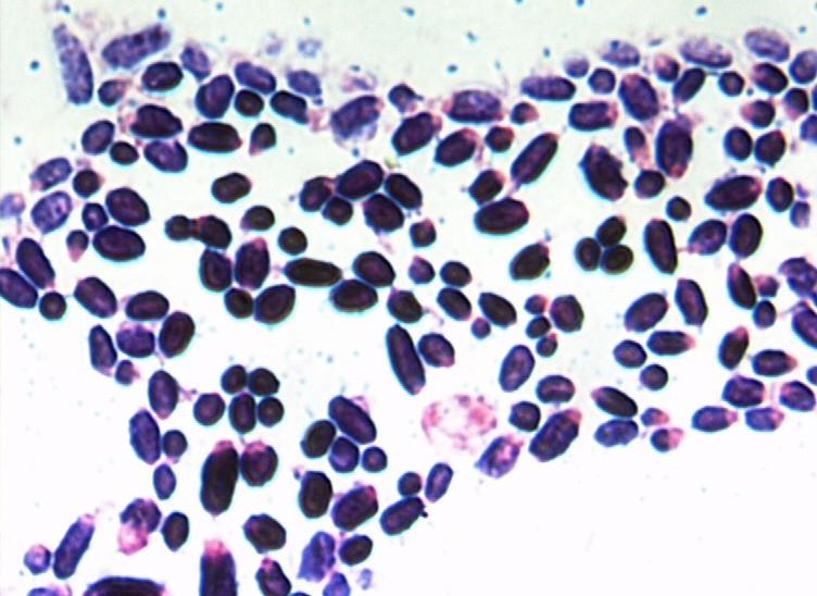 Saccharomyces