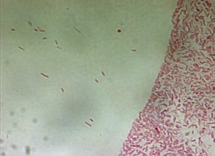 Serratia marcescens CCM 303 -Gramnegativní