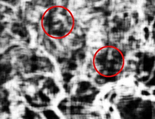 of convolution kernels (5x5, 7x7,