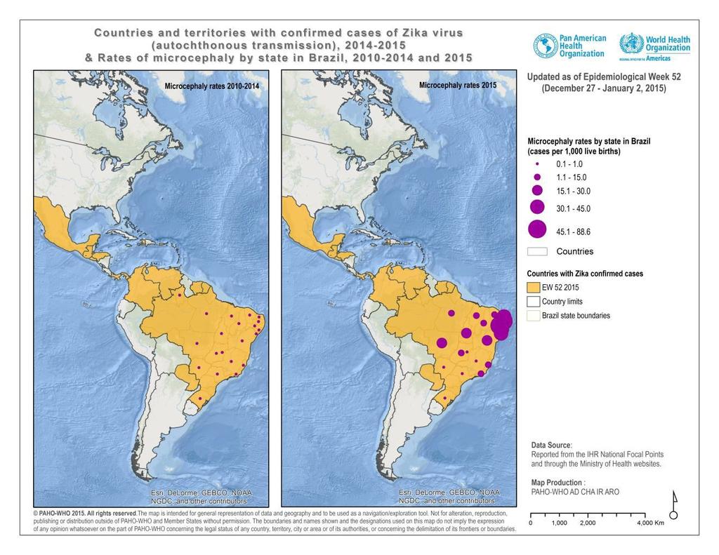 Zika Virus