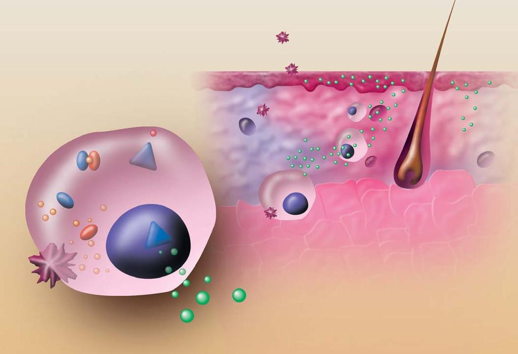 Přehledy-názory-diskuse je urãen pro pacienty od 2 let v lékové formû krému (1%). Sná enlivost pfiípravkû a úãinnost je individuální, tak jako u v ech dermatologick ch extern.