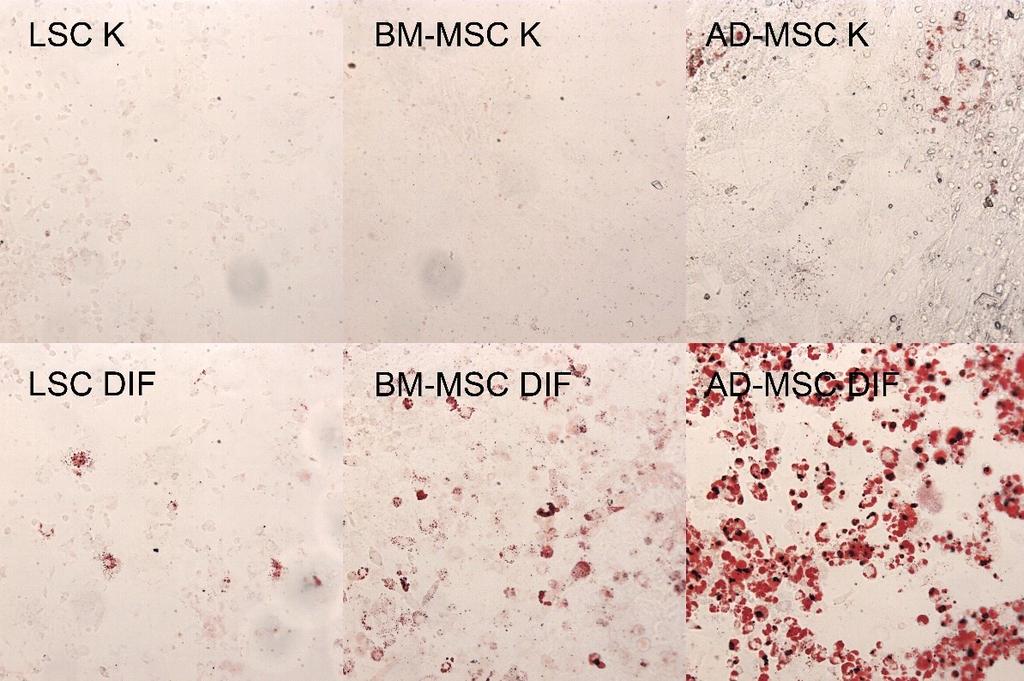 R e la tiv n í e x p re s e g e n u 6.2.2 Diferenciace SC Po stimulaci diferenciačními činidly jsou BM-MSC, AD-MSC a LSC schopny diferencovat v buňky tukové a kostní tkáně.