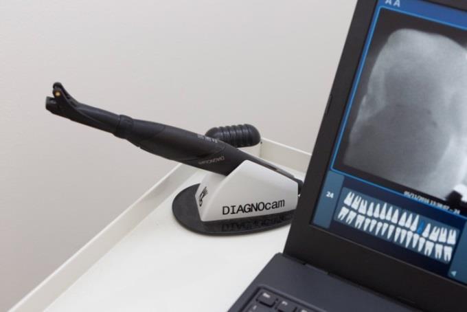 Obrázek 7 DIAGNOcam [zdroj: https://pbs.twimg.com/media/c4tq0ofwcaaodh_.jpg] DIAGNOcam dobře detekuje zubní kaz již počátečním stádiu.