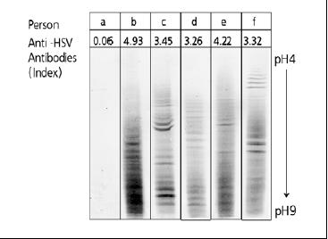 Variabilita antiinfekční