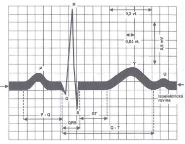 2 Rozměření EKG Klinické posuzování EKG se často opírá o relativně jednoduché měření intervalů mezi pěti základními body významných vln EKG signálu.