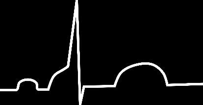 krátký PR (PQ) interval, vlna δ Syndrom