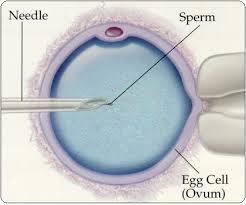 vpravení spermie do středu vajíčka pomocí