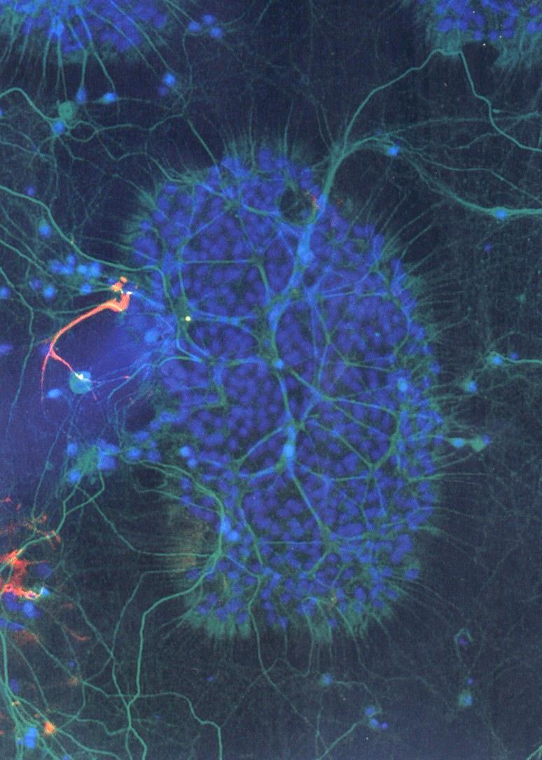 Vícenásobné barvení: - v jednom experimentu označení různých receptorů pomocí rozdílných fluorescenčních barviv - postupné snímání obrázků s různými