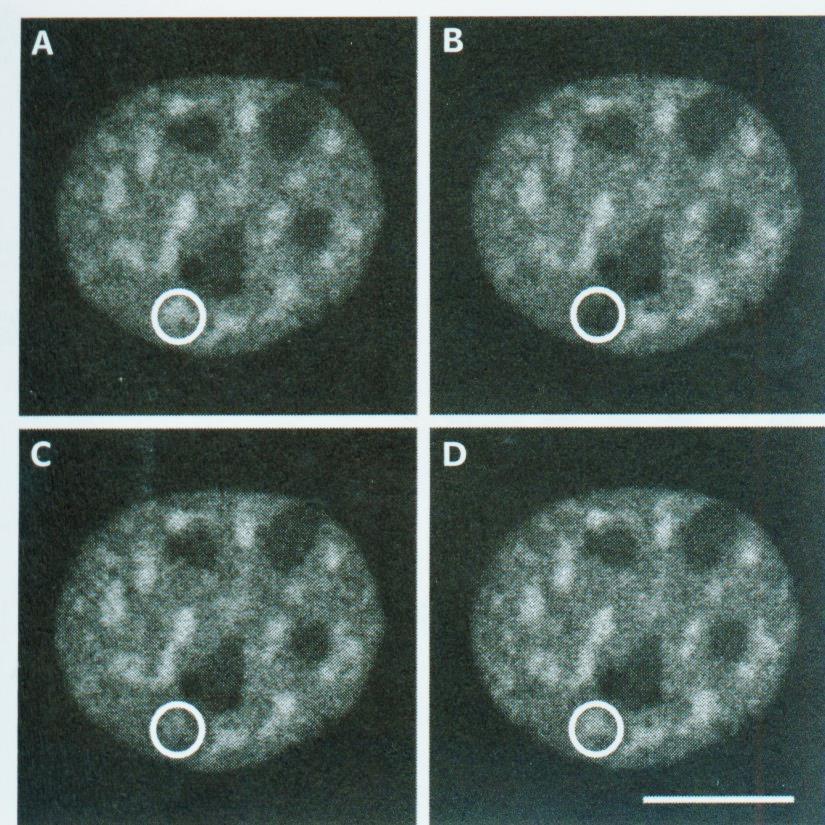 Vybělení fluorescence FRAP - příklad jádro savčí buňky jaderná skvrna po vybělení* Analýza pohybu jednoho ze sestřihových faktorů nahromaděného v jaderné