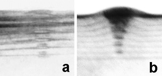TEM AFM 7