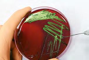 VÁŠ PARTNER PRO MIKROBIOLOGICKOU LABORATOŘ vyměnit. Bez výměny aortální srdeční chlopně by brzy zemřela. Jenže chirurgické otevření hrudníku by pro 86letou ženu bylo riskantní.