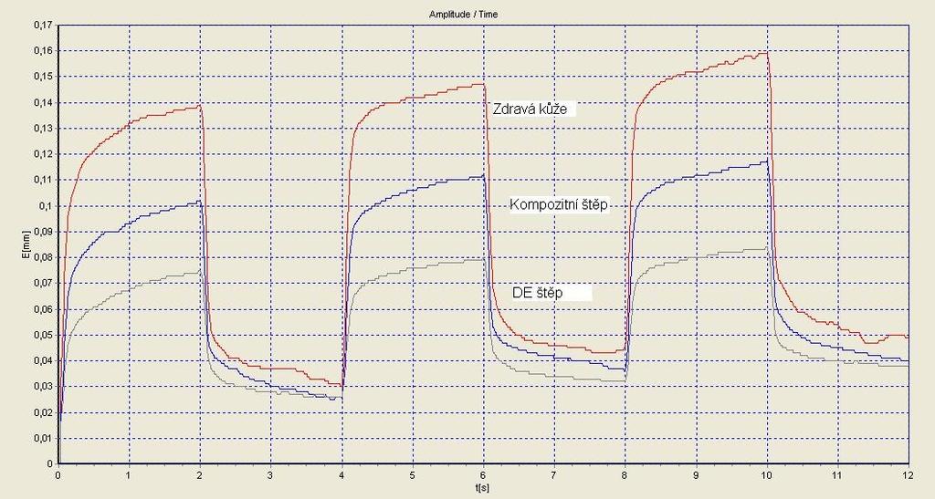 Parametry VSS pro kompozitní štěp VSS celkem 3 4 4 3 3 3 Tab č. 14 VSS parametry v závislosti na čase pro kompozitní štěp. Parametry VSS pro DE štěp VSS celkem 5 6 6 5 4 4 Tab č.