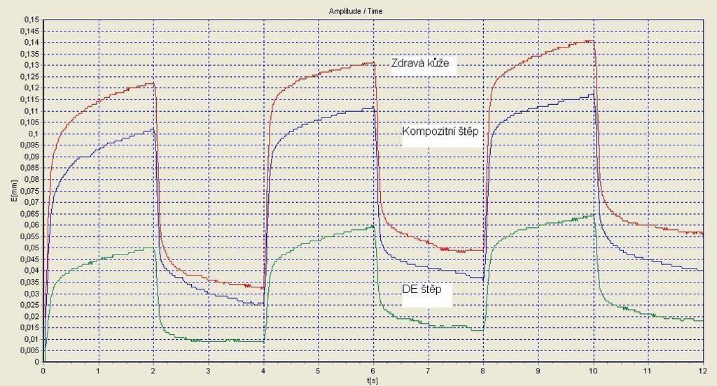 Parametry VSS pro DE štěp VSS celkem 7 6 5 5 5 5 Tab č. 19 VSS parametry v závislosti na čase pro DE štěp. Kutometrické křicky Graf č. 16 Kutometrické křivky zdravé kůže, kompozitního a DE štěpu.