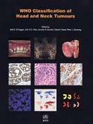 282 KNIHOVNA LKS 12/2018 WHO CLASSIFICATION OF HEAD AND NECK TUMOURS Adel K. El-Naggar, John K. C. Chen, Jennifer R. Grandis, Takashi Takata, Pieter J. Slootweg (ed.