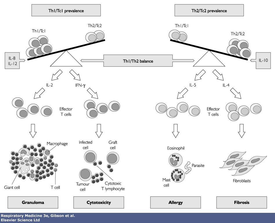 Obr.1 Th1/Th2 rovnováha v imunologické reakci. Převzato z Gibson et al. Respiratory Medicine. Rizikové faktory Byla objevena řada faktorů majících pravděpodobný vliv na vznik a vývoj IPF.