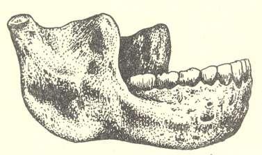 Obr. 18. Spodní čelist Homo heidelbergensis, nalezená u německého Maueru (podle Mazák 1977).