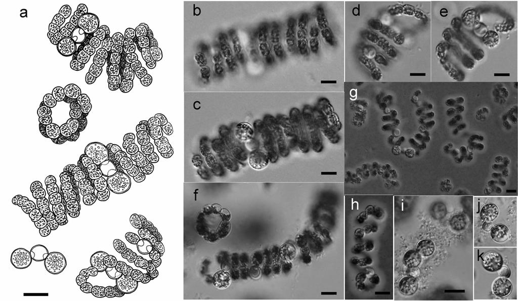 Anabaena