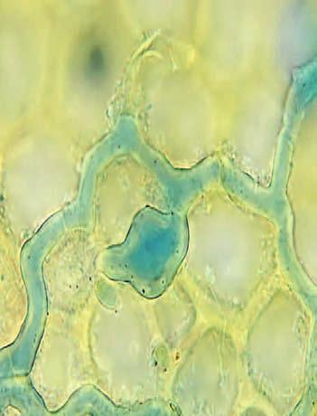 Ze systematického hlediska náležejí do řádu kustřebkotvaré (Pezizales) a spolu s blízce příbuznými rody kulosporka (Lamprospora, obr. 6), Neottiella (obr. 7), Octosporella (obr.