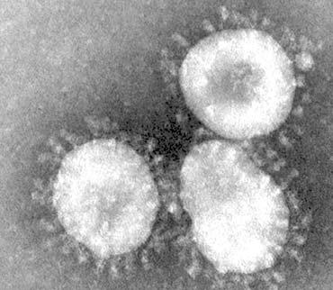 Geografické rozdíly ve výskytu pneumonie u dětí Obrázek 4 Mikroskopické vyšetření hlenů s