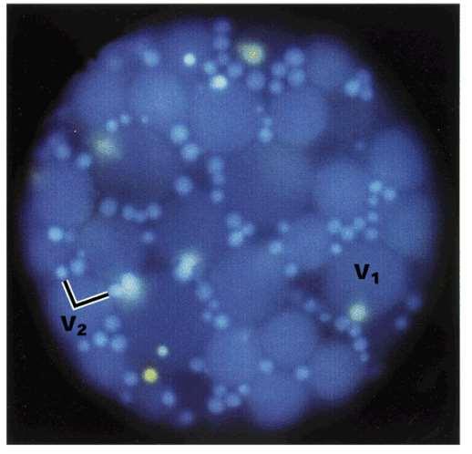 Více typů vakuol v rostlinných buňkách Lytická vakuola (LV): - nízké ph - obsahuje hydrolytické enzymy - g-tips na tonoplastu - ve vegetativních pletivech Vakuola se