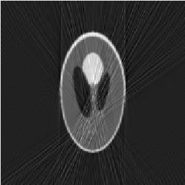 8: Simulace artefaktu vlivem kvantového šumu- artefakt: a) první, b) druhý, c) třetí, d) čtvrtý Druhý artefakt: Nastavení parametrů artefaktu: Artefakt / Kvantový šum / Volba