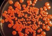Obr. 5: Kolonie Rhodotorula glutinis na Petriho misce [48] 2.2.4.2 Rod Cryptococcus Rod Cryptococcus ředíme mezi kvasinky, jejichž kolonie jsou zbarvené krémově případně do žluta.