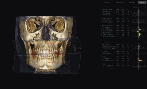 To znamená, že můžeme realizovat celý plán léčby od vložení implantátů, nasazení pilíře až po zhotovení zubní náhrady.